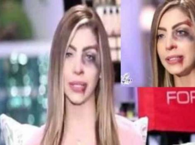  اكبر مشكلة بين الشرطة الالمانية والرجال السوريين. تفاصيل صادمه جدا