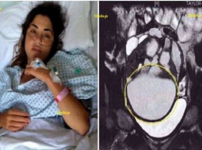  أثناء علاقتها الزوجية شعرت بشيء يتحرّك في بطنها.. وبعد زيارة الطبيب اكتشفت كارثه